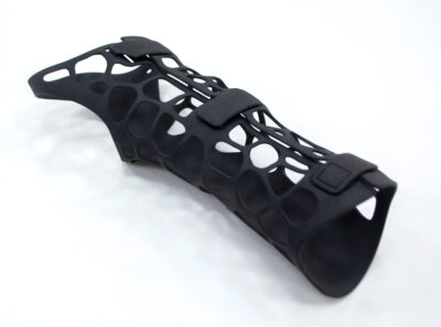 Black orthopedic plastic prosthesis printed on powder 3D printer